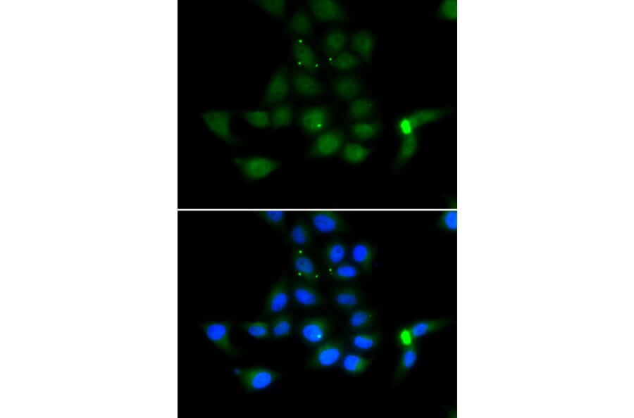 Immunofluorescence - TAT antibody from Signalway Antibody (39162) - Antibodies.com