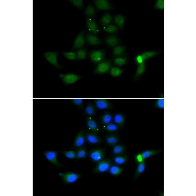 Immunofluorescence - TAT antibody from Signalway Antibody (39162) - Antibodies.com