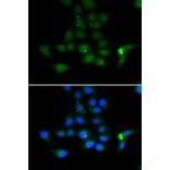 Immunofluorescence - TAT antibody from Signalway Antibody (39162) - Antibodies.com