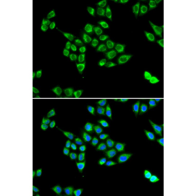 Immunofluorescence - PC antibody from Signalway Antibody (38807) - Antibodies.com