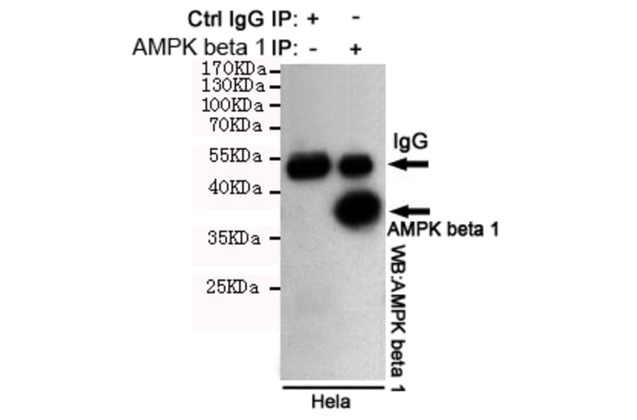 Immunoprecipitation - AMPK beta 1 Monoclonal Antibody from Signalway Antibody (27201) - Antibodies.com