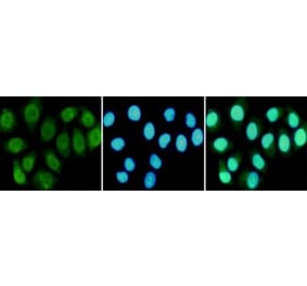 Immunocytochemistry - RPA70 Monoclonal Antibody from Signalway Antibody (27212) - Antibodies.com