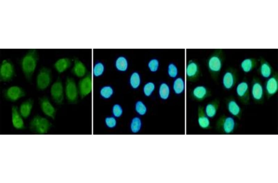 Immunocytochemistry - RPA70 Monoclonal Antibody from Signalway Antibody (27212) - Antibodies.com