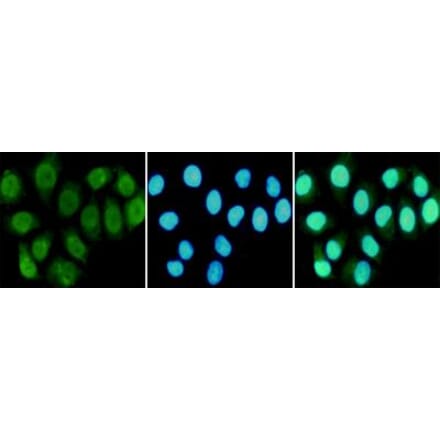 Immunocytochemistry - RPA70 Monoclonal Antibody from Signalway Antibody (27212) - Antibodies.com