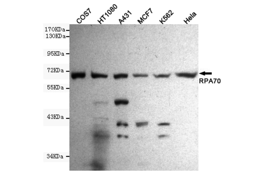 Western blot - RPA70 Monoclonal Antibody from Signalway Antibody (27212) - Antibodies.com