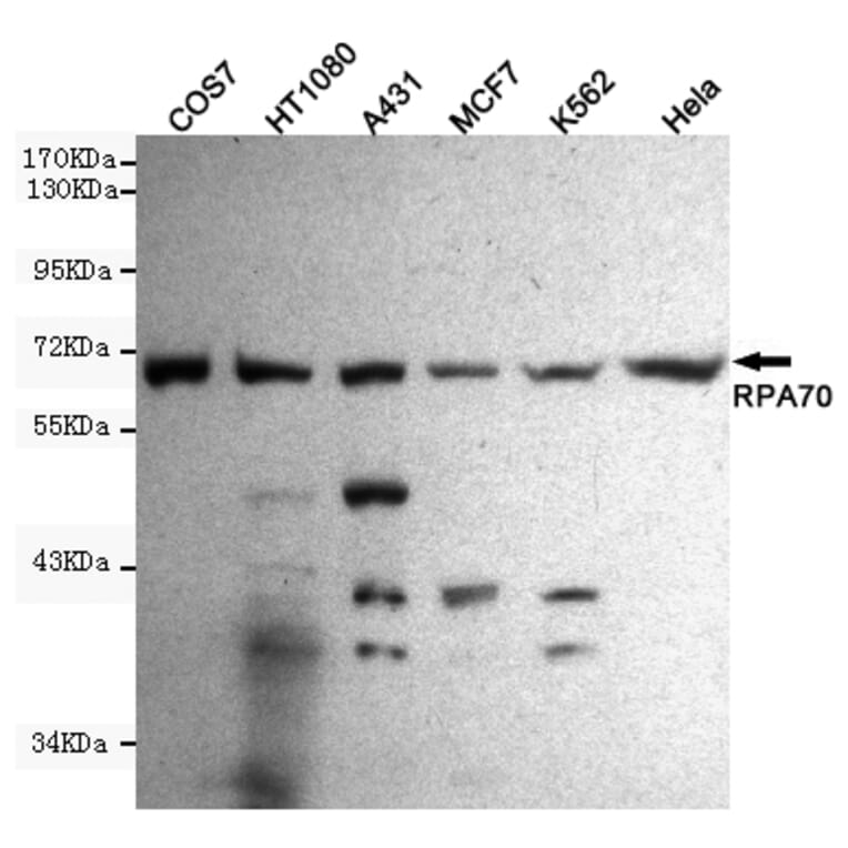 Western blot - RPA70 Monoclonal Antibody from Signalway Antibody (27212) - Antibodies.com