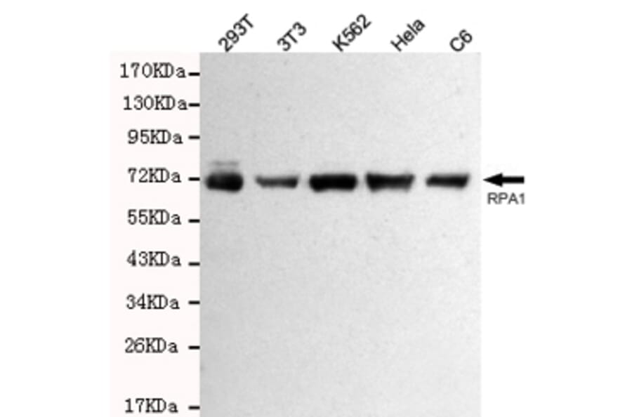 Western blot - RPA70 Monoclonal Antibody from Signalway Antibody (27212) - Antibodies.com