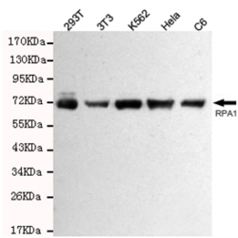Western blot - RPA70 Monoclonal Antibody from Signalway Antibody (27212) - Antibodies.com
