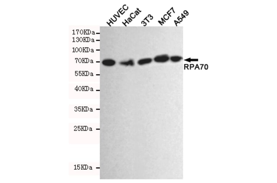 Western blot - RPA70 Monoclonal Antibody from Signalway Antibody (27212) - Antibodies.com