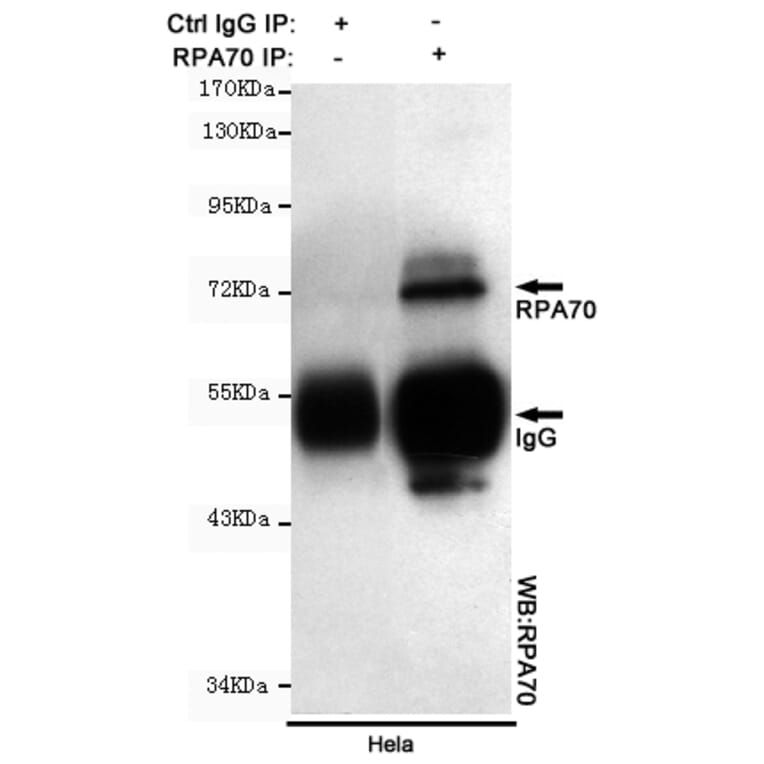 Immunoprecipitation - RPA70 Monoclonal Antibody from Signalway Antibody (27212) - Antibodies.com