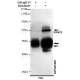Immunoprecipitation - RPA70 Monoclonal Antibody from Signalway Antibody (27212) - Antibodies.com