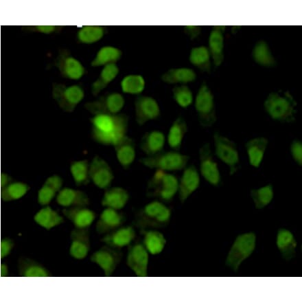 Immunocytochemistry - Ku70 Monoclonal Antibody from Signalway Antibody (27220) - Antibodies.com