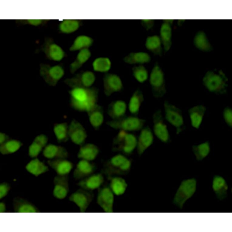 Immunocytochemistry - Ku70 Monoclonal Antibody from Signalway Antibody (27220) - Antibodies.com