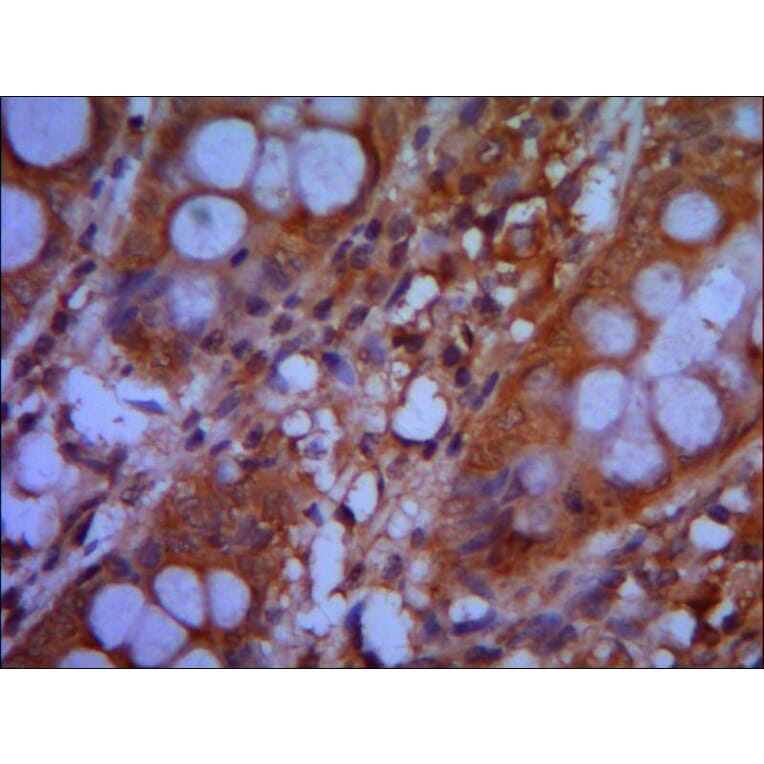 CHD3 Monoclonal Antibody from Signalway Antibody (27035) - Antibodies.com
