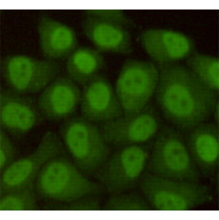 Immunocytochemistry - hHR23b Monoclonal Antibody from Signalway Antibody (27219) - Antibodies.com