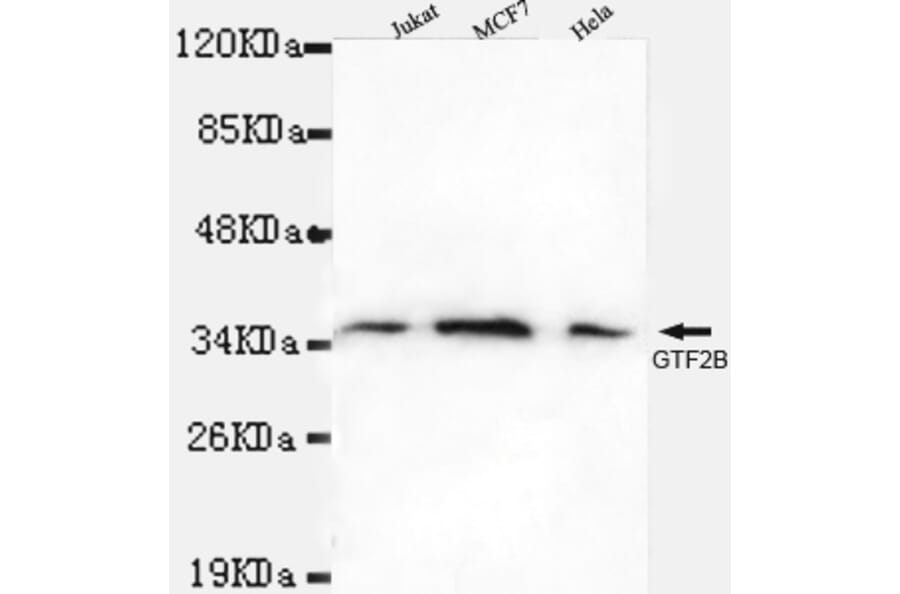 TFIIB Monoclonal Antibody from Signalway Antibody (27007) - Antibodies.com