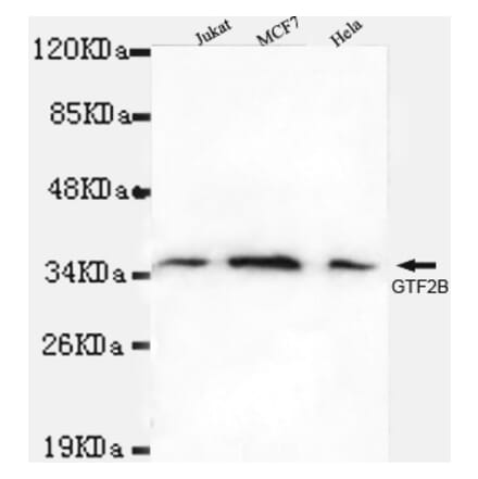 TFIIB Monoclonal Antibody from Signalway Antibody (27007) - Antibodies.com