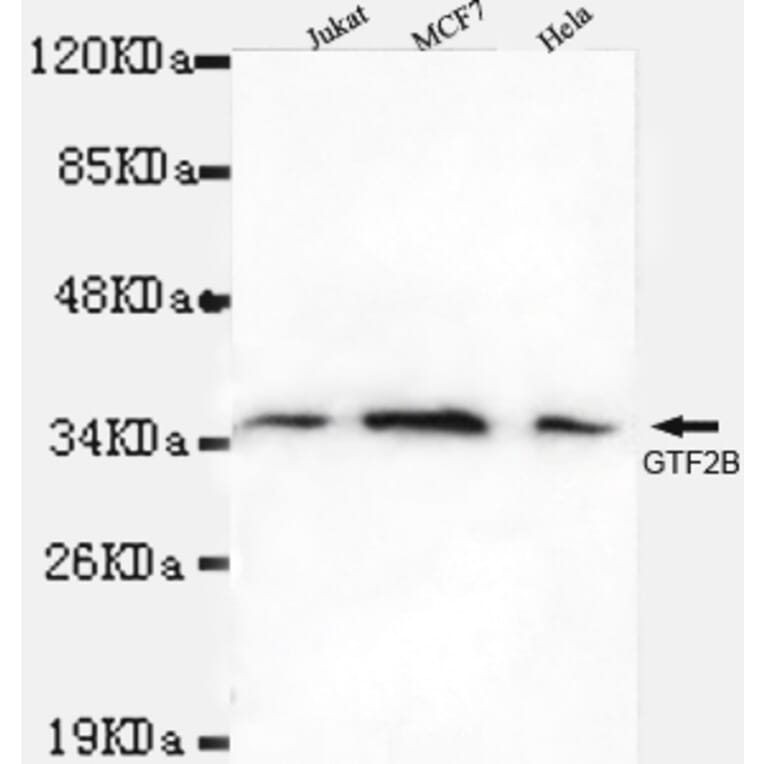 TFIIB Monoclonal Antibody from Signalway Antibody (27007) - Antibodies.com