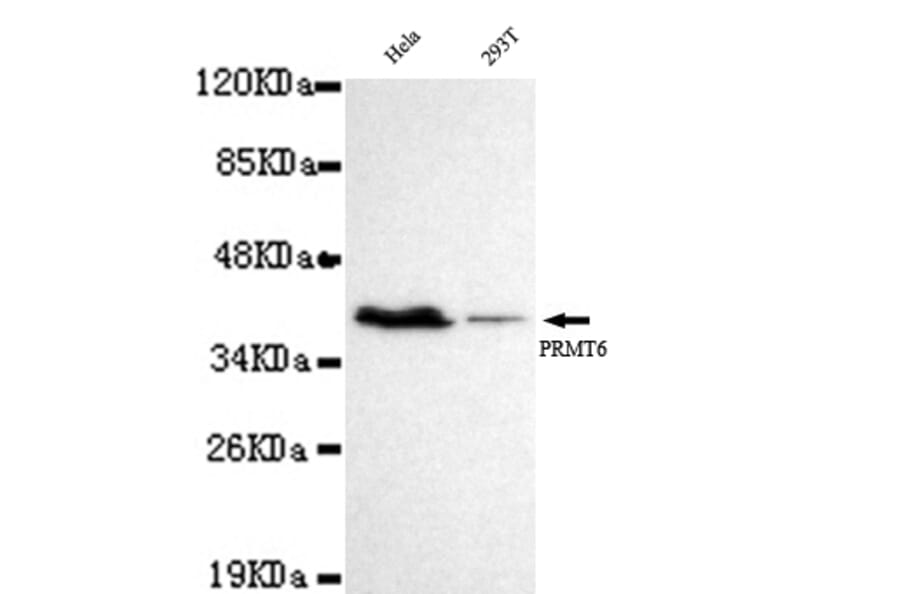 PRMT6 Monoclonal Antibody from Signalway Antibody (27017) - Antibodies.com
