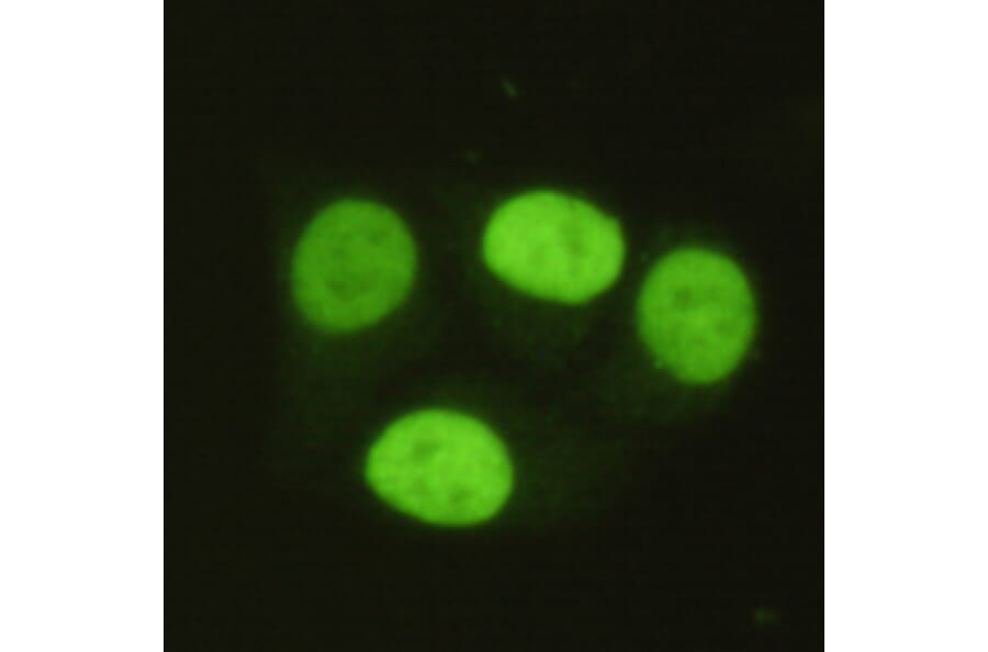 PRMT6 Monoclonal Antibody from Signalway Antibody (27017) - Antibodies.com