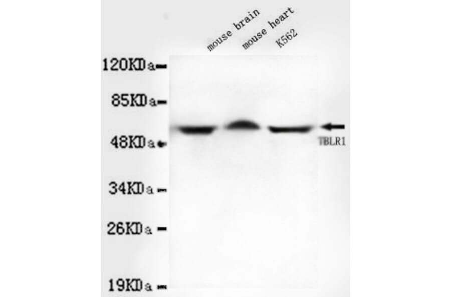 TBLR1 Monoclonal Antibody from Signalway Antibody (27036) - Antibodies.com