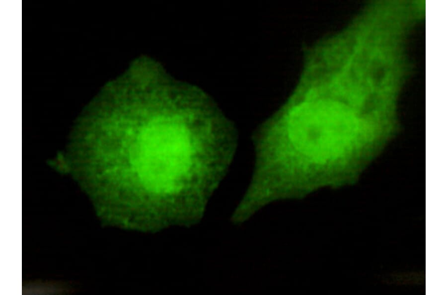 TBLR1 Monoclonal Antibody from Signalway Antibody (27036) - Antibodies.com