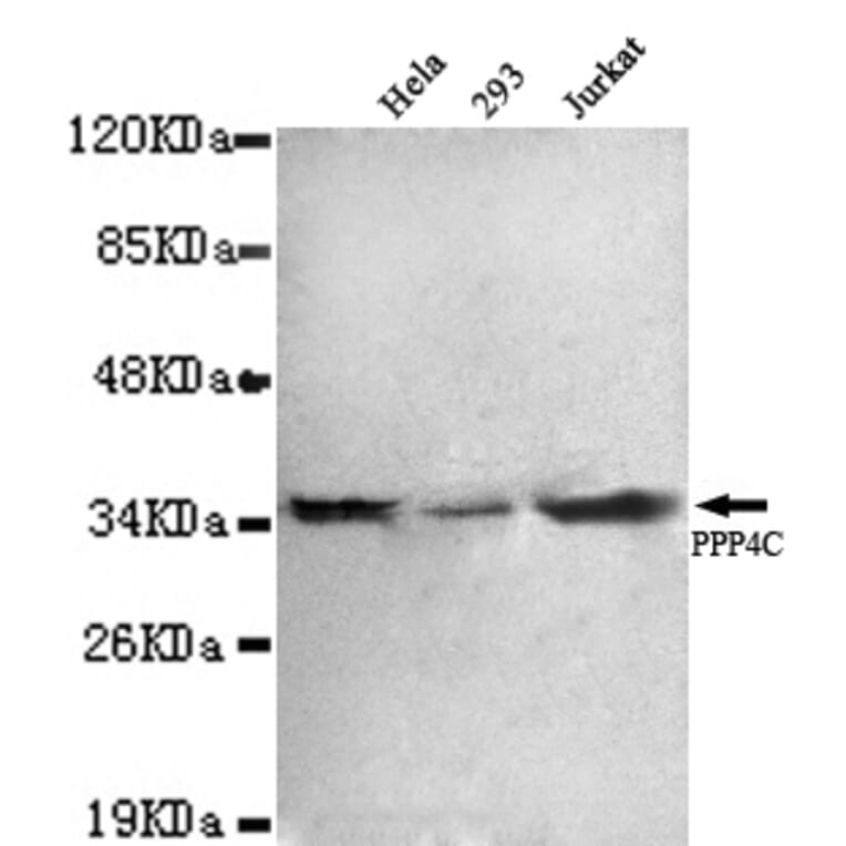 Protein Phosphatase 4C Monoclonal Antibody from Signalway Antibody (27020) - Antibodies.com