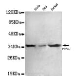 Protein Phosphatase 4C Monoclonal Antibody from Signalway Antibody (27020) - Antibodies.com
