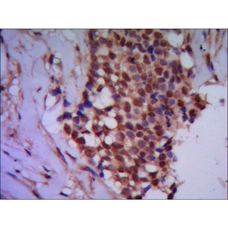 Protein Phosphatase 4C Monoclonal Antibody from Signalway Antibody (27020) - Antibodies.com