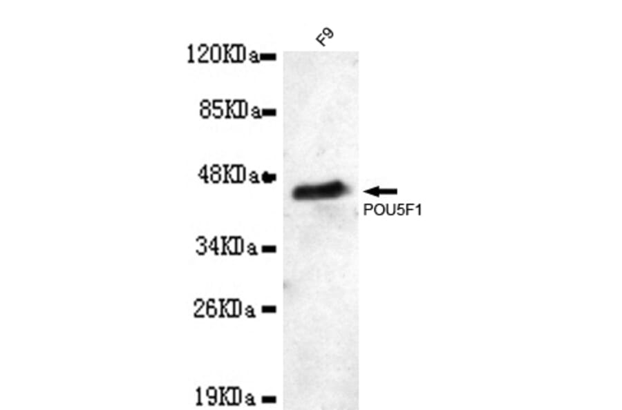 POU5F1 Monoclonal Antibody from Signalway Antibody (27014) - Antibodies.com