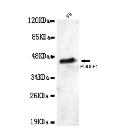 POU5F1 Monoclonal Antibody from Signalway Antibody (27014) - Antibodies.com