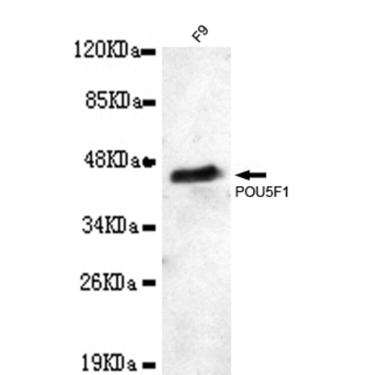 POU5F1 Monoclonal Antibody from Signalway Antibody (27014) - Antibodies.com
