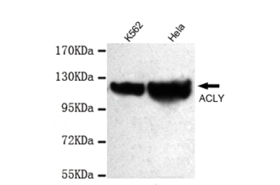 ATP-Citrate Lyase (C-term) Monoclonal Antibody from Signalway Antibody (27048) - Antibodies.com