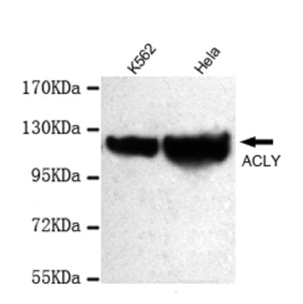ATP-Citrate Lyase (C-term) Monoclonal Antibody from Signalway Antibody (27048) - Antibodies.com
