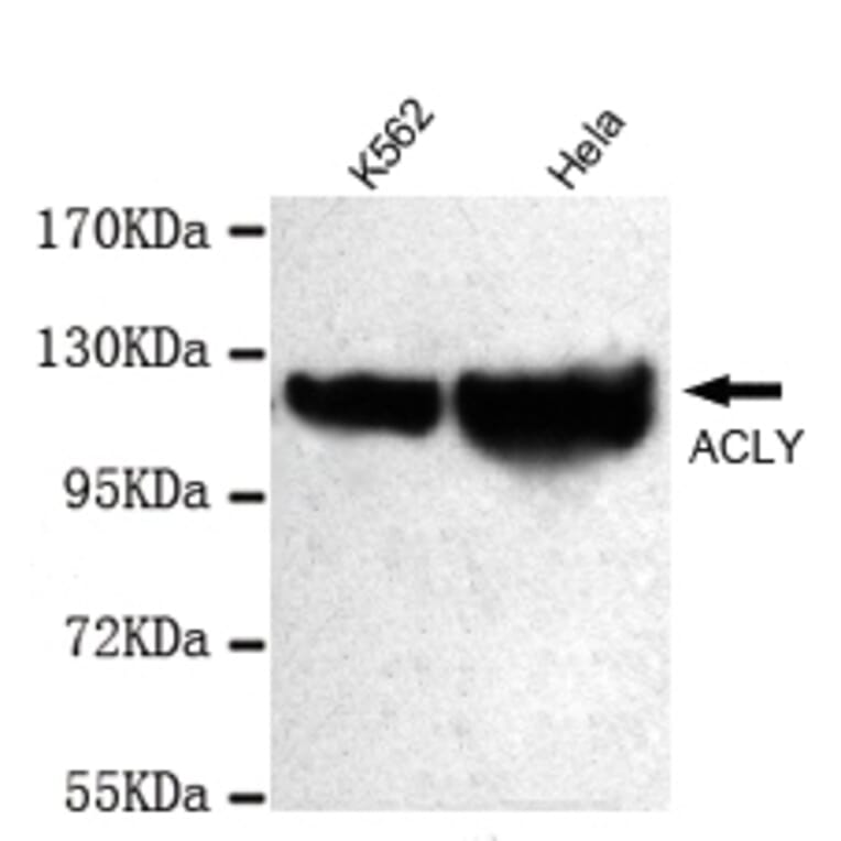 ATP-Citrate Lyase (C-term) Monoclonal Antibody from Signalway Antibody (27048) - Antibodies.com