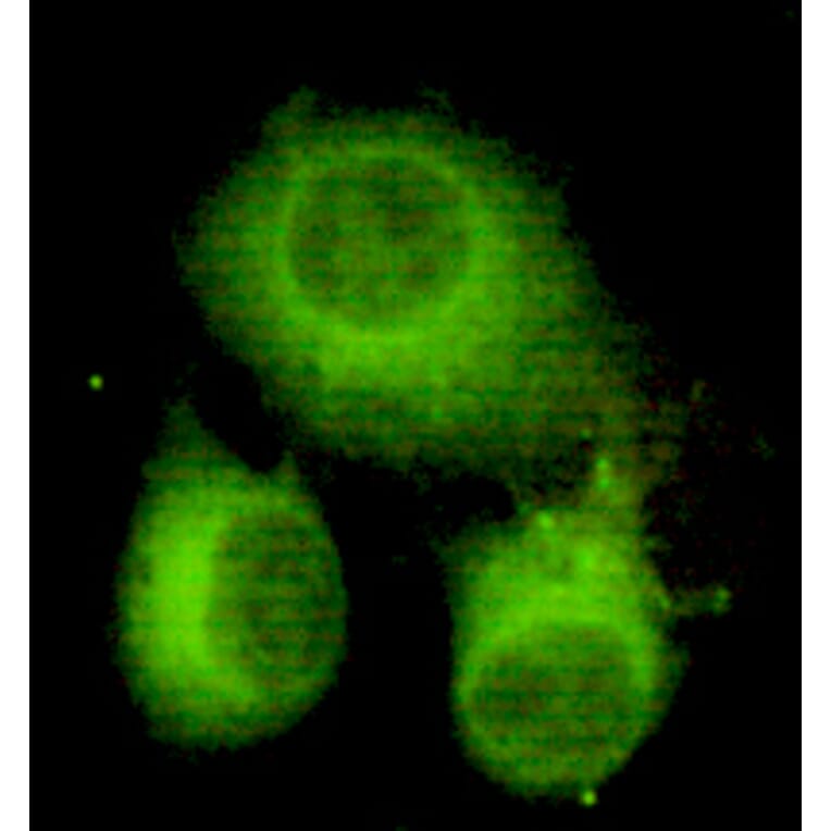 ATP-Citrate Lyase (C-term) Monoclonal Antibody from Signalway Antibody (27048) - Antibodies.com