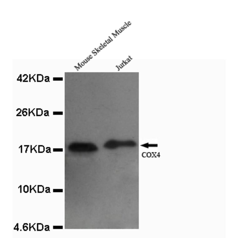 COX4 (isoform1) Monoclonal Antibody from Signalway Antibody (27080) - Antibodies.com
