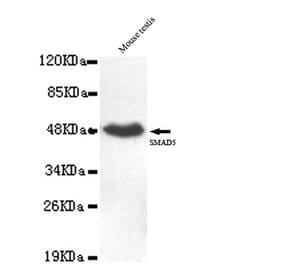 SMAD5 (C-term) Monoclonal Antibody from Signalway Antibody (27047) - Antibodies.com