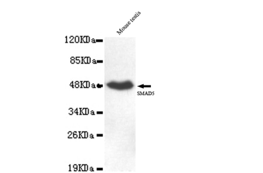 SMAD5 (C-term) Monoclonal Antibody from Signalway Antibody (27047) - Antibodies.com