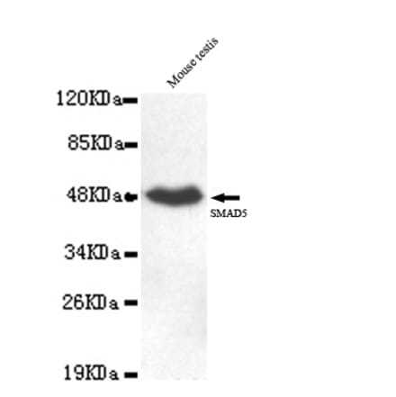 SMAD5 (C-term) Monoclonal Antibody from Signalway Antibody (27047) - Antibodies.com