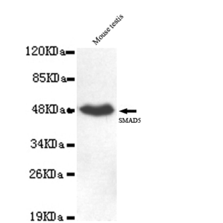 SMAD5 (C-term) Monoclonal Antibody from Signalway Antibody (27047) - Antibodies.com