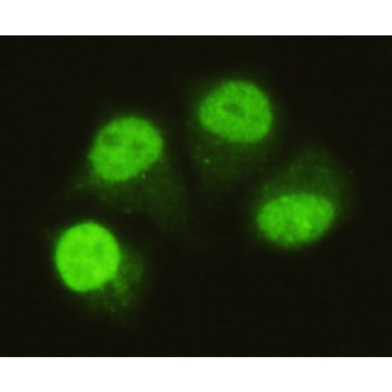 SMAD5 (C-term) Monoclonal Antibody from Signalway Antibody (27047) - Antibodies.com