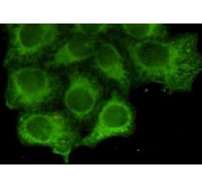 Immunocytochemistry - Keratin 18 Monoclonal Antibody from Signalway Antibody (27178) - Antibodies.com
