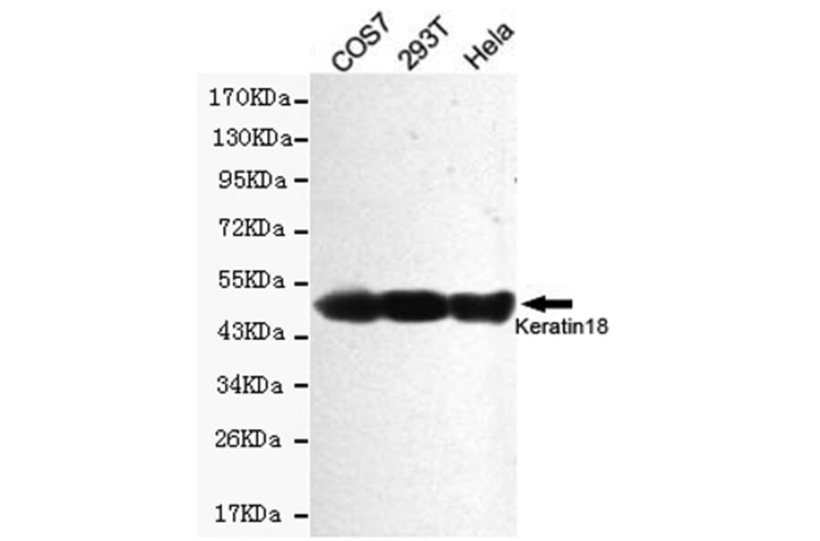 Western blot - Keratin 18 Monoclonal Antibody from Signalway Antibody (27178) - Antibodies.com