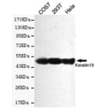 Western blot - Keratin 18 Monoclonal Antibody from Signalway Antibody (27178) - Antibodies.com