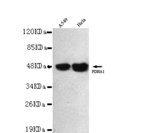 Pyruvate Dehydrogenase (C-term) Monoclonal Antibody from Signalway Antibody (27025) - Antibodies.com