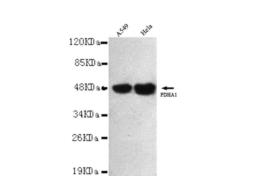 Pyruvate Dehydrogenase (C-term) Monoclonal Antibody from Signalway Antibody (27025) - Antibodies.com