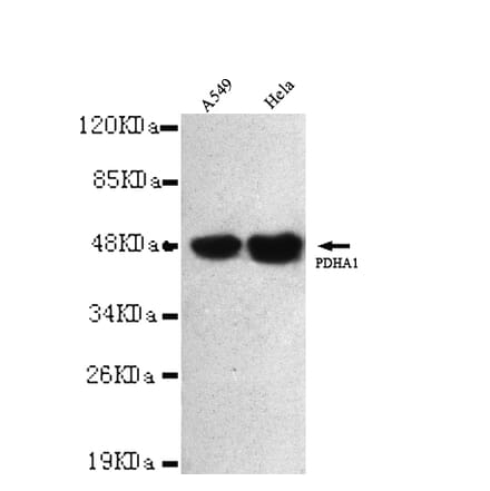 Pyruvate Dehydrogenase (C-term) Monoclonal Antibody from Signalway Antibody (27025) - Antibodies.com