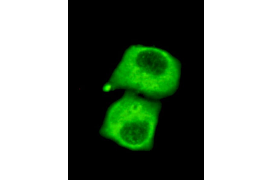 Pyruvate Dehydrogenase (C-term) Monoclonal Antibody from Signalway Antibody (27025) - Antibodies.com