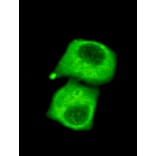 Pyruvate Dehydrogenase (C-term) Monoclonal Antibody from Signalway Antibody (27025) - Antibodies.com
